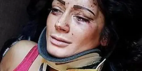 Cremona, violenza choc: viene aggredita in casa e massacrata di botte