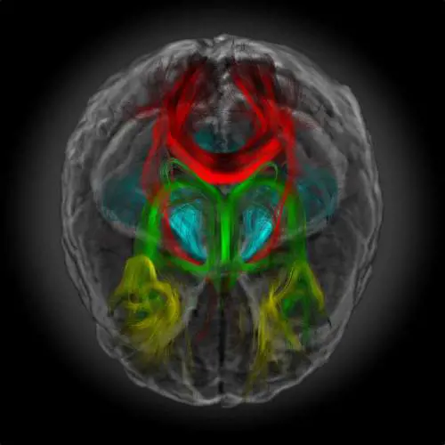 Le immagini della risonanza magnetica trasformate in opere d'arte