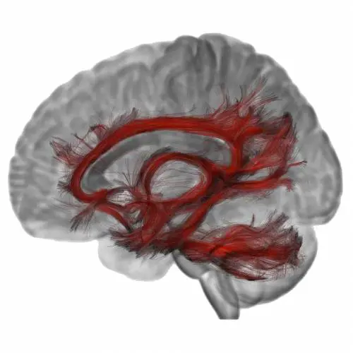 Il radiologo che trasforma le risonanze magnetiche ​al cervello in opere d'arte