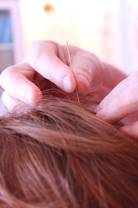 L’agopuntura può servire ad alleviare i disturbi della menopausa