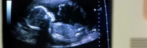 Rodrigo, il bambino nato senza un volto: sospeso il medico