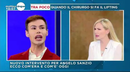 Angelo Sanzio rifiutato dalla madre: "Colpa della chirurgia estetica"