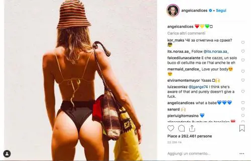 La curiosa cicatrice sul lato B di Candice Sweanepoel: "Vaccino in Africa"
