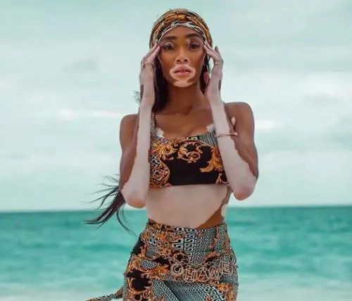 Winnie Harlow: "Grazie al successo porto la mia famiglia in vacanza"