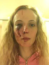 Madre aggredita dalla baby-gang