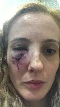 "Fate un po' di silenzio". E la gang di adolescenti massacra di botte una madre