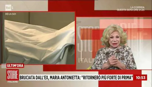 Donna bruciata dall'ex: "Mi ha buttato la benzina e poi mi ha detto 'muori'"