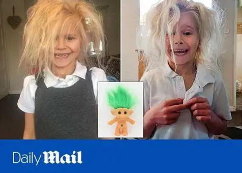 Wynter Seymour, la bambina con la "Sindrome di Pierino Porcospino"