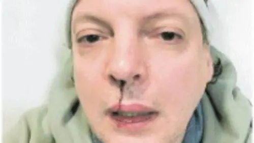 Il comico Dado pestato  dall'ex  di sua  figlia