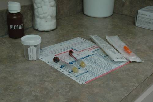 Esame delle urine efficace quanto un pap test