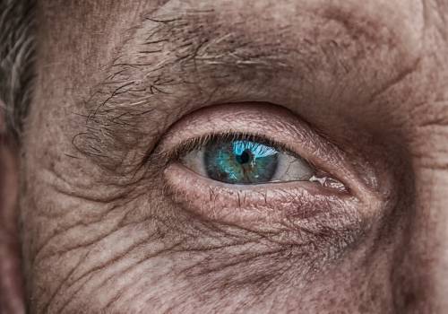 Glaucoma: in arrivo collirio ricavato dal cordone ombelicale