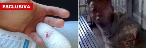 Torino, nigeriano morde poliziotto e gli strappa la falange