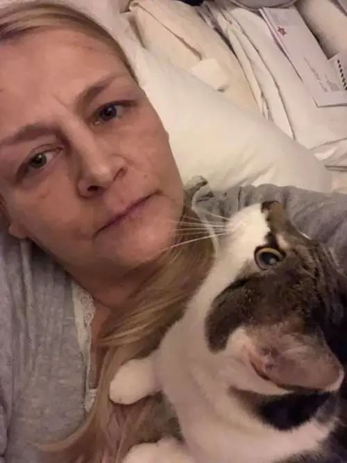 Joanne, invalida dopo il morso della zecca