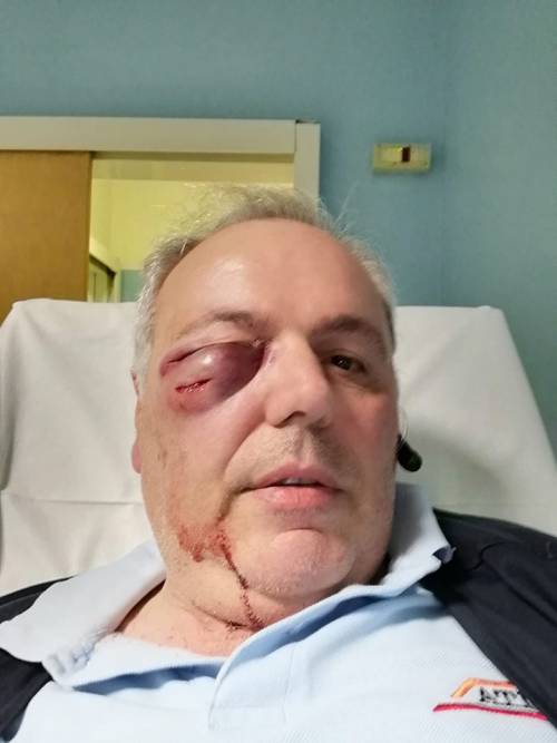 Milano, autista picchiato a sangue da un ubriaco