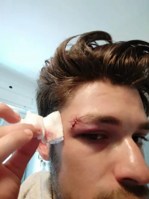 Roma, presi quattro aggressori degli attivisti del Cinema America