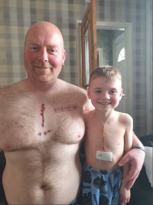 Il figlio è stato operato: padre si tatua una cicatrice come la sua