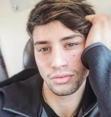 Niccolò Bettarini mostra le ferite dell'aggressione choc