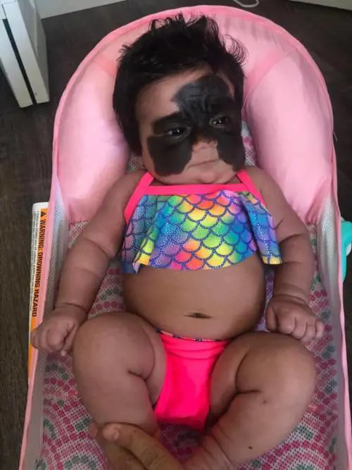 Bimba nasce con una macchia sul volto: "Un mostro, uccidetela"