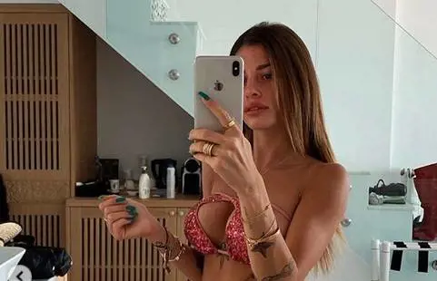 La accusano di essere rifatta. Chiara Nasti replica: "Sono regolare senza chirurgo"