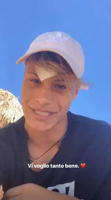 Denis Dosio aggredito, 6 punti per un bicchiere spaccato sulla fronte