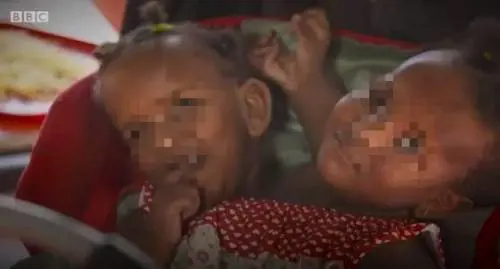 Due gemelle siamesi vicine alla morte, il papà: "Non scelgo chi salvare"