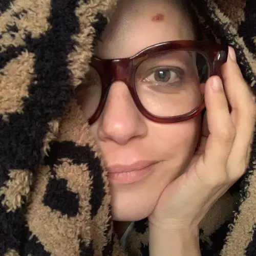 Selma Blair, la foto della lotta alla sclerosi scuote i social