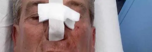 Prova a allontanare alcuni rom: sindaco della Lega viene pestato a sangue
