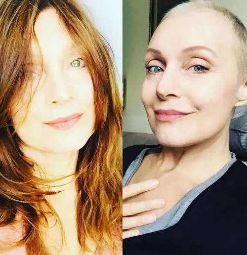 L'attrice di Un medico in famiglia e il doloroso racconto sulla malattia