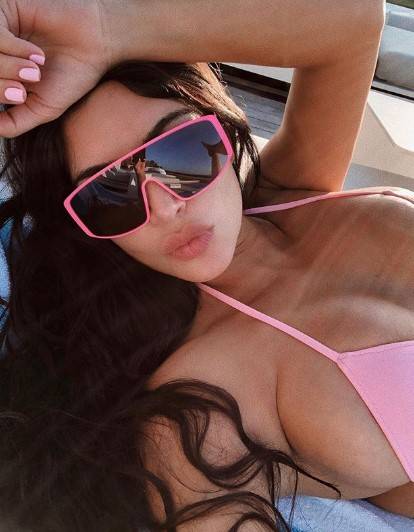 Kim Kardashian teme di avere il lupus