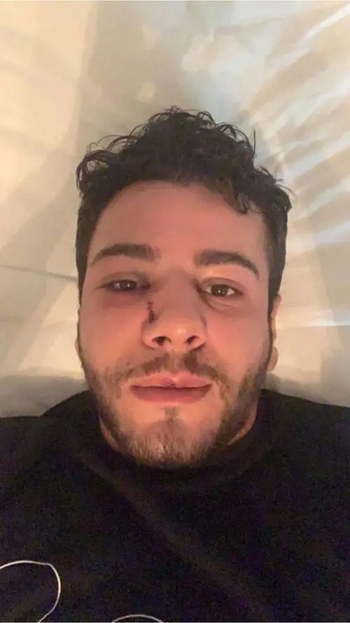 "Sei gay". E lo pestano a sangue. La denuncia su Facebook