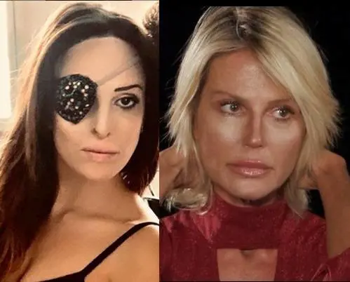 Gessica Notaro preoccupata per la Caldonazzo: "Ho un occhio solo ma certe cose le vedo da lontano"