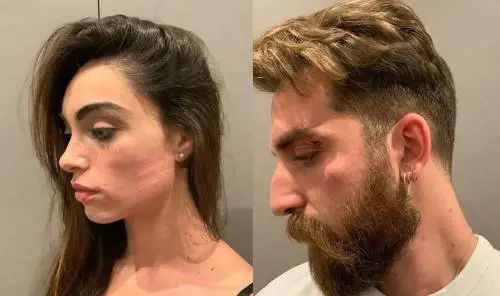 Lorella Boccia e Niccolò Presta derubati e minacciati con un coltello: "Uomini di m..."