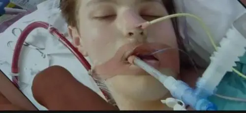 La storia di Ewan: "Ho rischiato la vita per lo svapo"