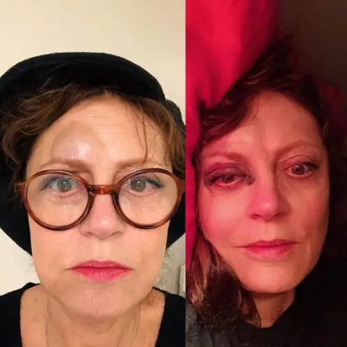 Brutto incidente per Susan Sarandon: commozione cerebrale e naso rotto