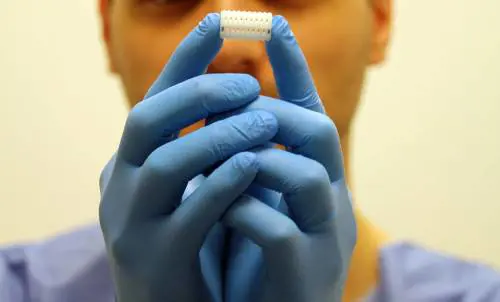 Primo 'bronco' in 3D impiantato al Bambino Gesù