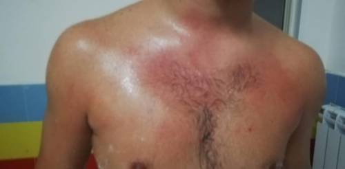 Salerno, aggredito e picchiato da un genitore un giovane calciatore under 17
