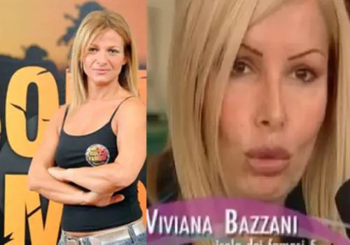 Così la Bazzani ha perso la vista: "Colluttazione con un clandestino"