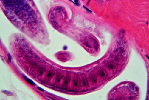Allerta cinghiale infetto: "Il batterio trichinella è letale per l'uomo"