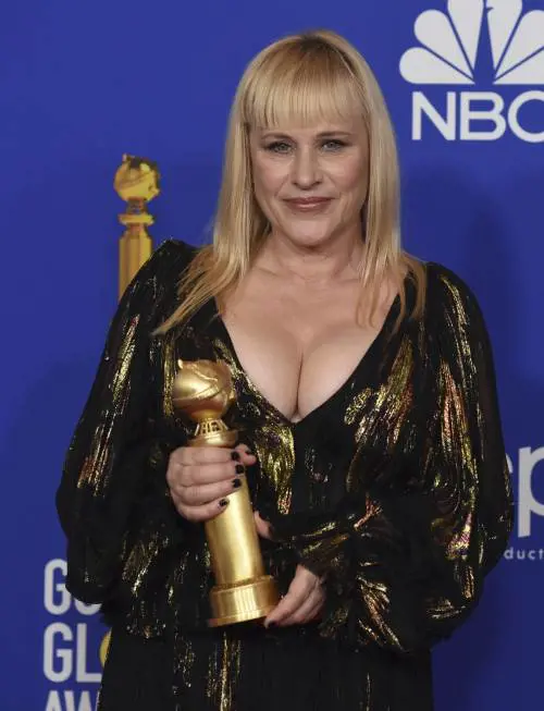 Severance, Patricia Arquette nella nuova serie tv Apple