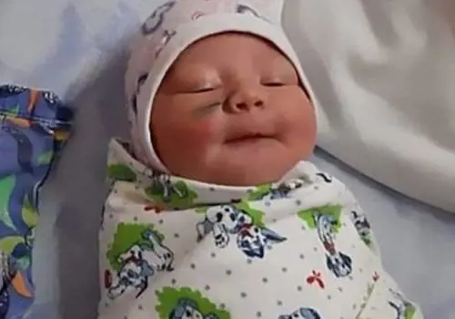 Neonata sfregiata al volto nel cesareo, i medici: "Si è mossa troppo"