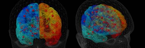 La fisica per curare le malattie: così crea cervelli umani virtuali