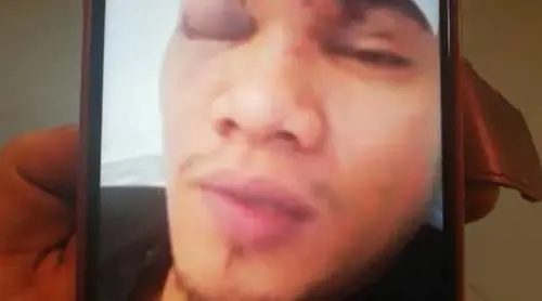 Cagliari, filippino picchiato su un bus perché scambiato per cinese