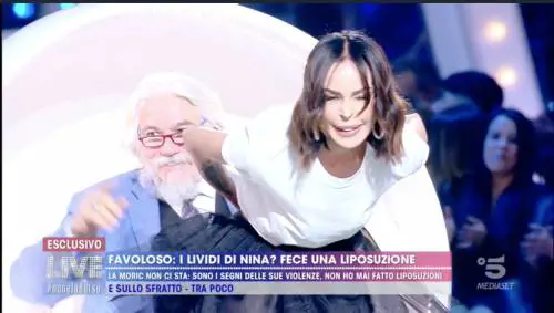 Live Non è la d'Urso, Nina Moric contro tutti. I lividi sono compatibili con una liposuzione