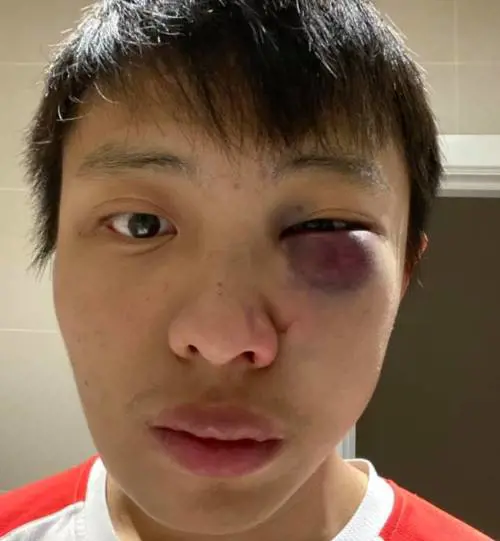 "Non voglio il tuo Coronavirus", pestato studente asiatico