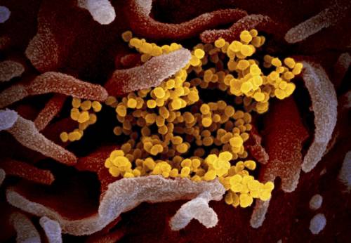 Coronavirus, lo studio: "Pazienti ancora contagiosi dopo la scomparsa dei sintomi"