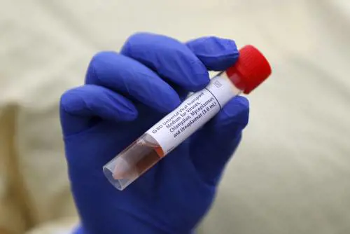Patente di immunità dal coronavirus: che cos'è e come la si ottiene