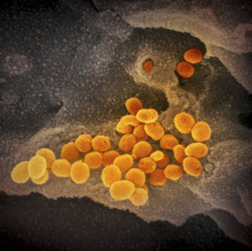 Quello che sappiamo (e che ancora non sappiamo) sul coronavirus