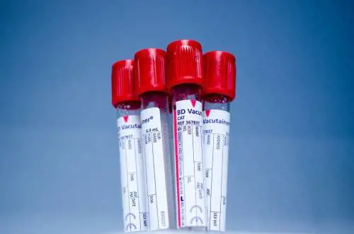 La terapia del sangue ancora non basta. La speranza? Nei maiali