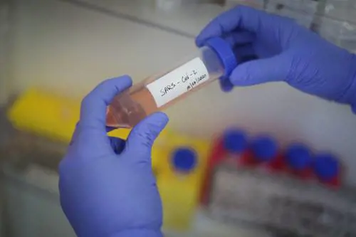 Lo studio choc sugli anticorpi: perché il vaccino può essere inutile