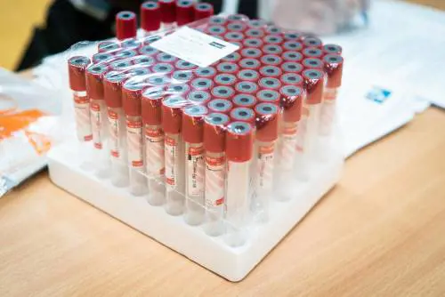 Lombardia, al via il 23 aprile dei primi test sierologici